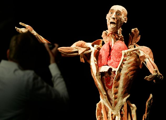 Murió Gunther von Hagens.