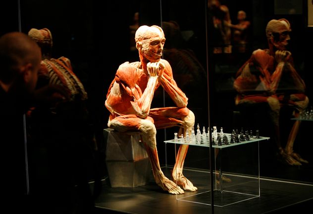 Murió Gunther von Hagens.