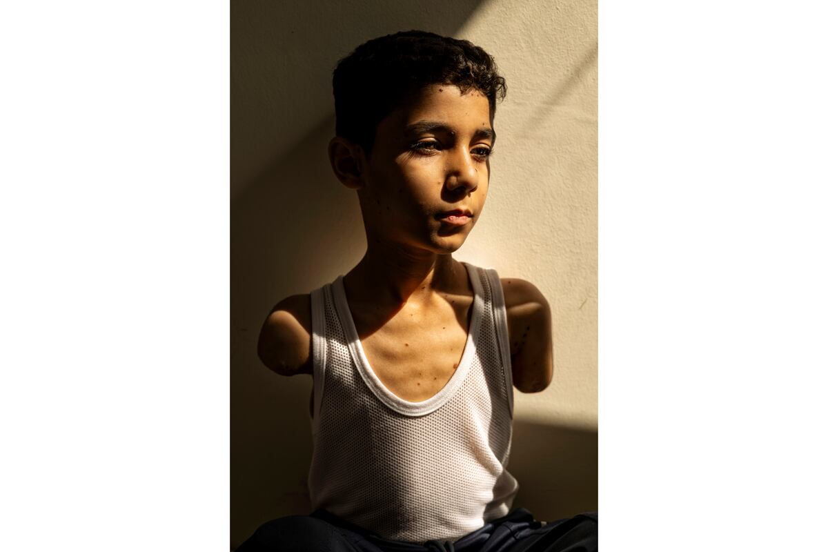 Esta imagen, distribuida por World Press Photo y tomada por Samar Abu Elouf para The New York Times, ganó el premio World Press Photo y muestra a Mahmoud Ajjour (9), que resultó herido en un ataque israelí en la Ciudad de Gaza en marzo de 2024 y recibió atención y atención médica en Doha, Qatar, el 28 de junio de 2024. (Samar Abu Elouf para The New York Times/World Press Photo vía AP)