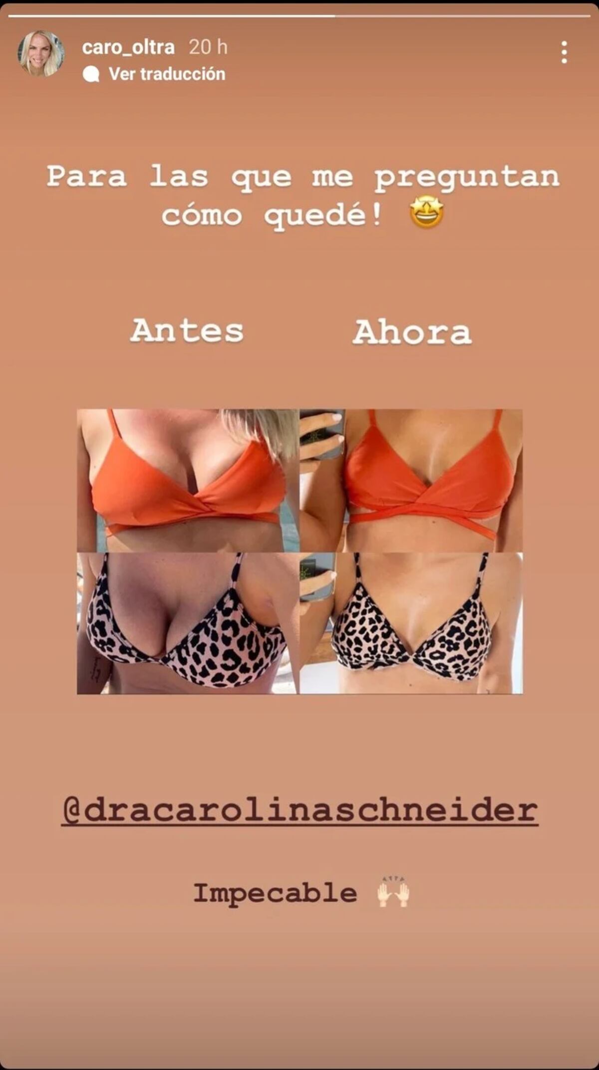 El antes y después de Carolina Oltra.