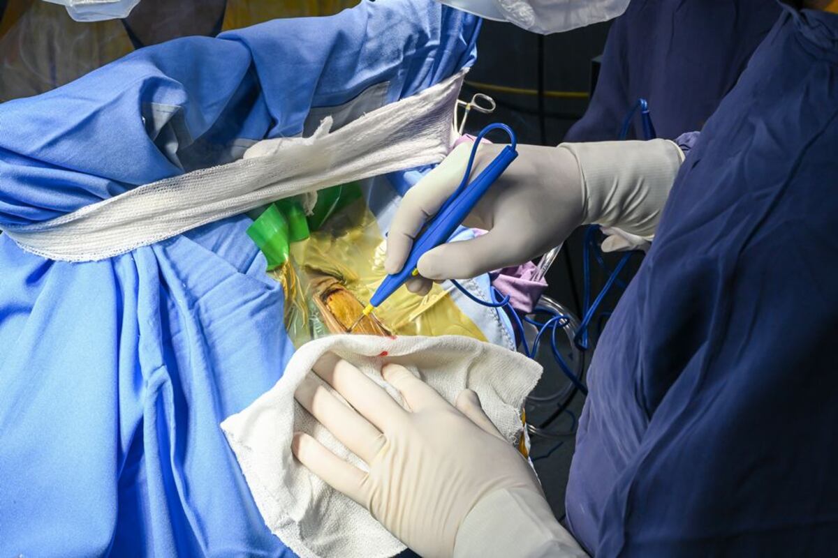 Realizaron cirugías cerebrales despiertas en un hospital público de Córdoba.