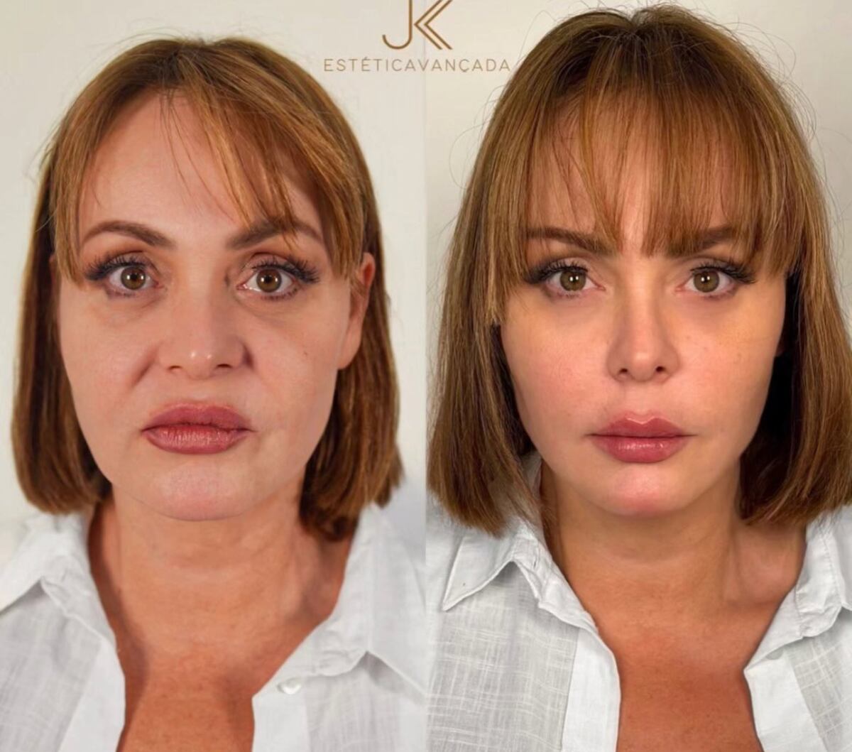 El cambio estético de Gaby Spanic que revolucionó las redes sociales.