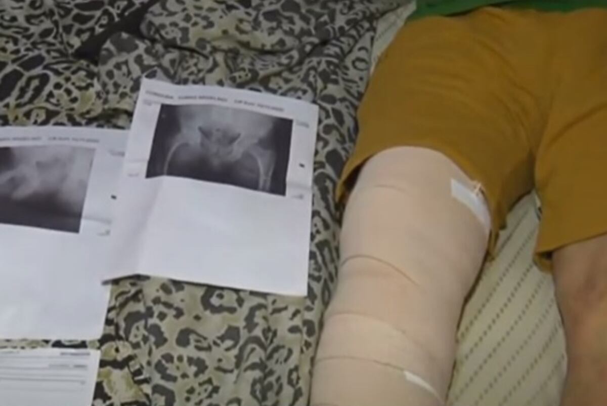 Clínica Romagosa. Tomás Córdoba asegura que fue víctima de una confusión, había otro paciente con el mismo apellido al que le tenían que poner una prótesis de rodilla.