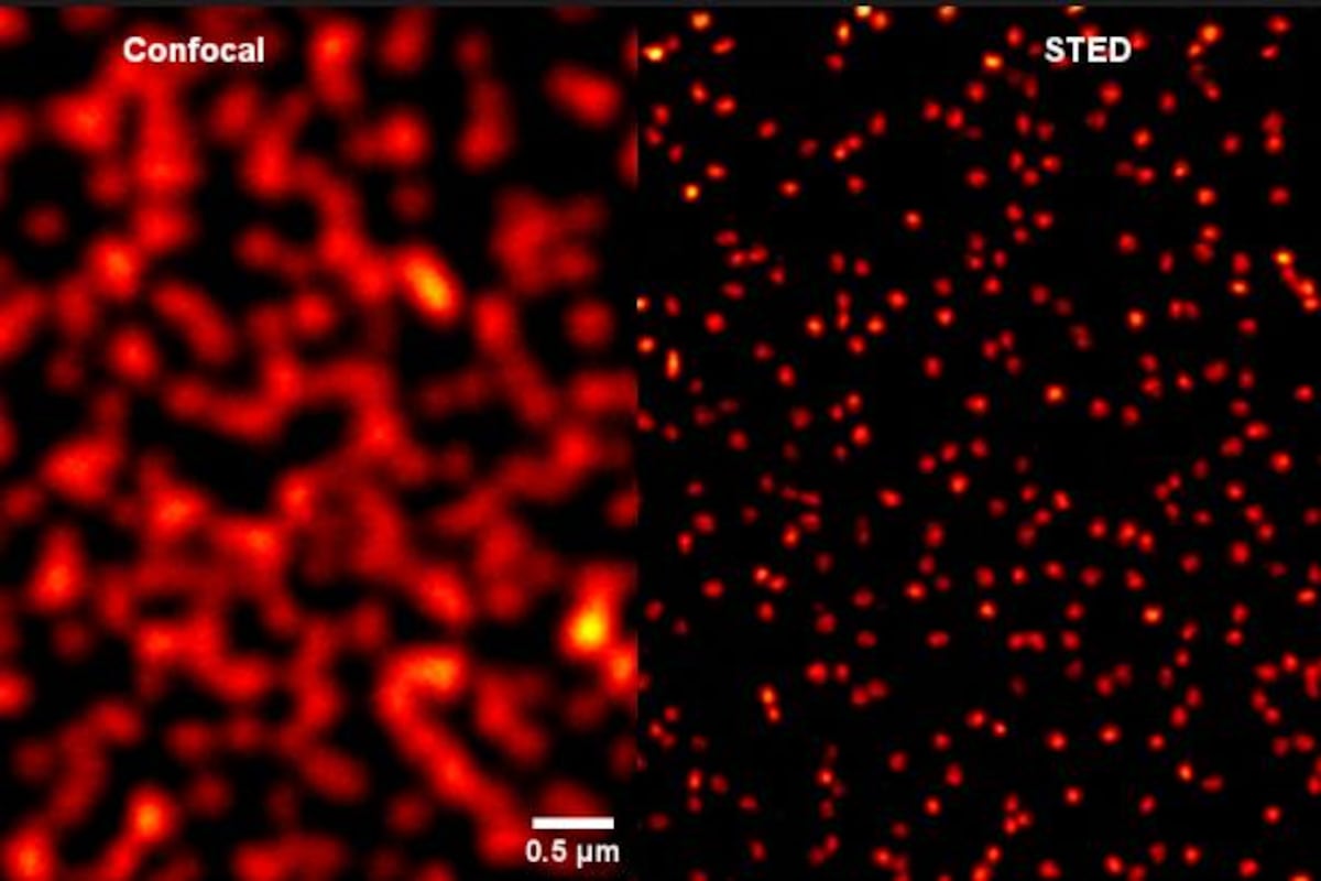 En la imagen se puede ver otra foto de una célula y la comparación de la misma zona con la microscopía confocal, lo que deja en evidencia el nivel de detalle que se alcanza con esta nueva tecnología.(Prensa UNC)