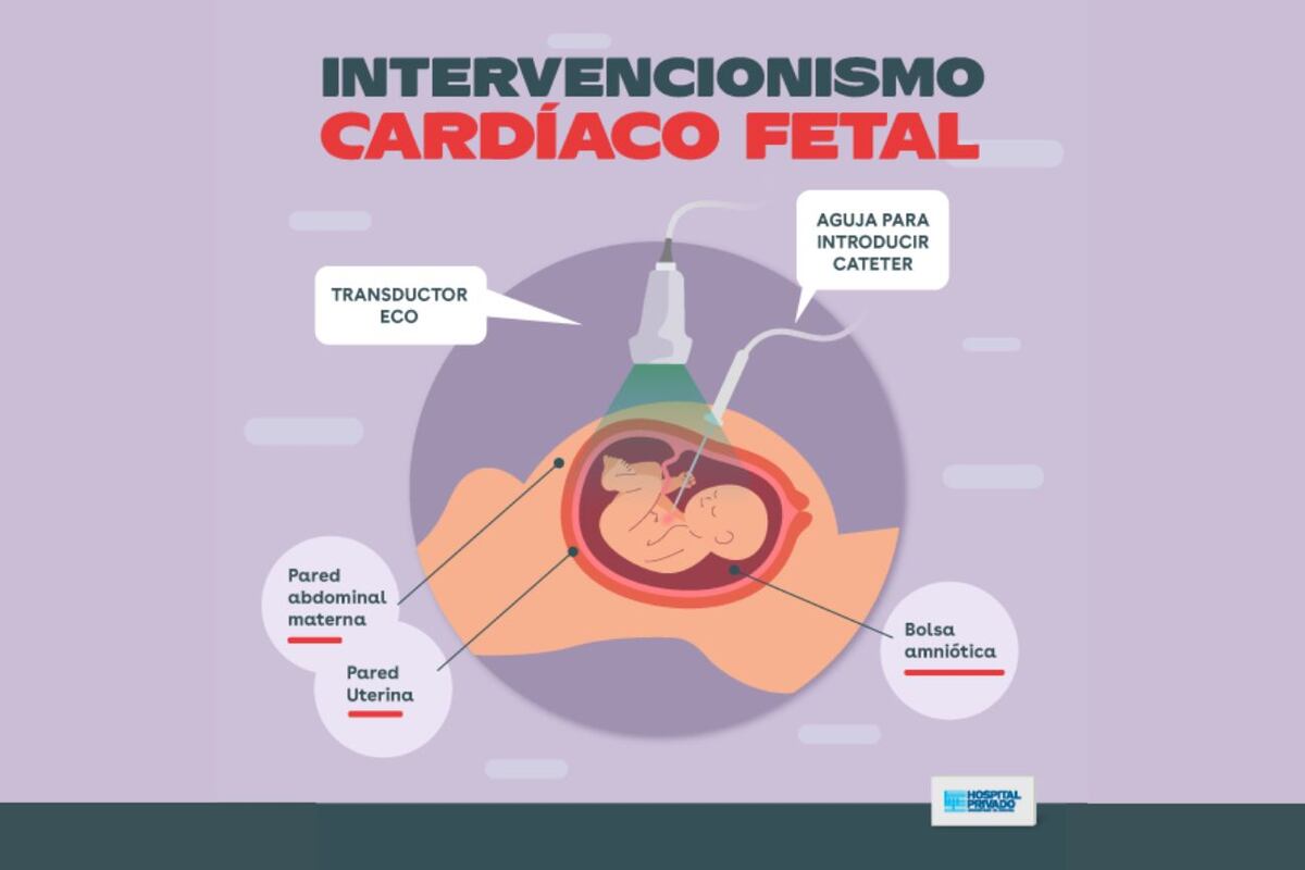Intervencionismo fetal.