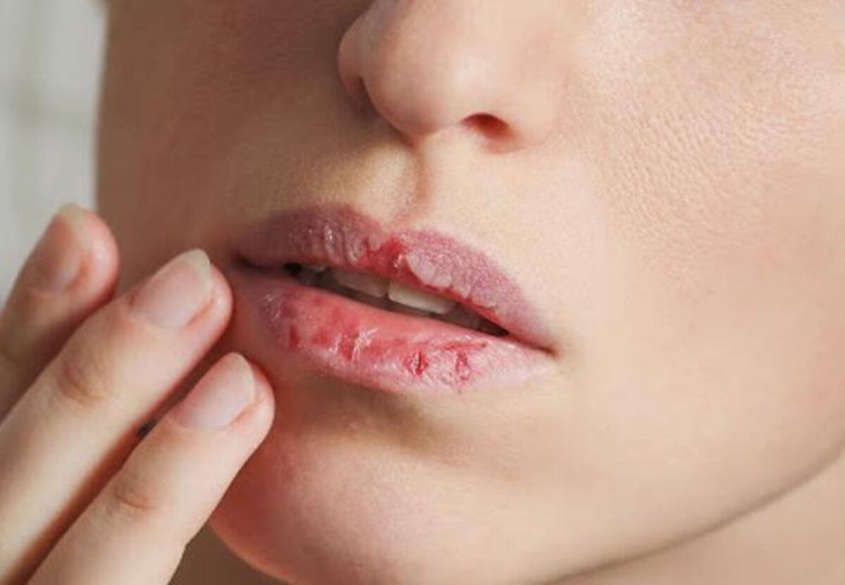 Qué dice el color de tus labios sobre tu salud