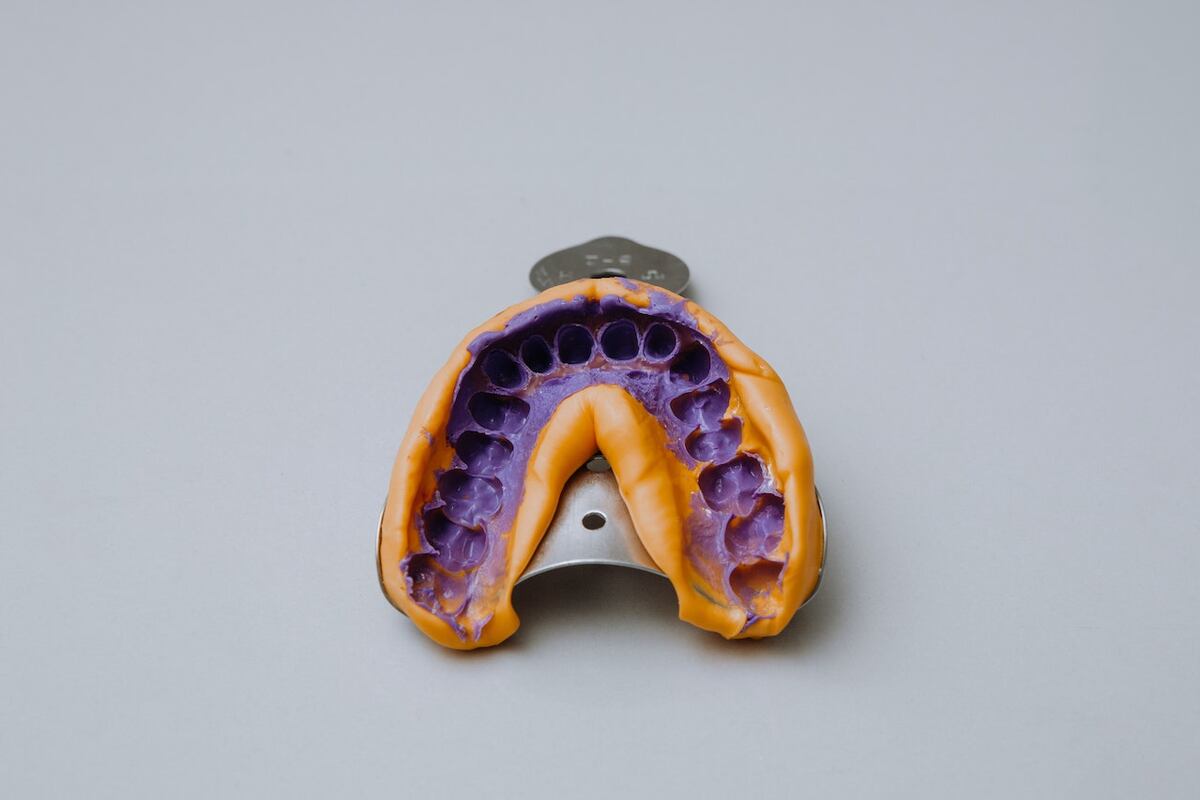 Lesiones bucales: prevenciones y cuidados con las prótesis dentales. (Imagen ilustrativa Pexels)