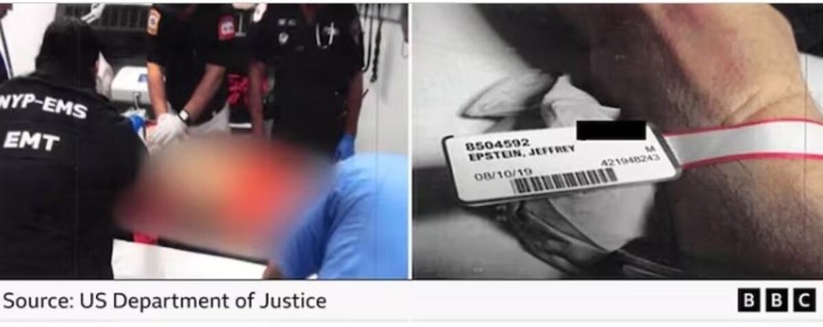 Estados Unidos difundió fotos del cuerpo de Jeffrey Epstein