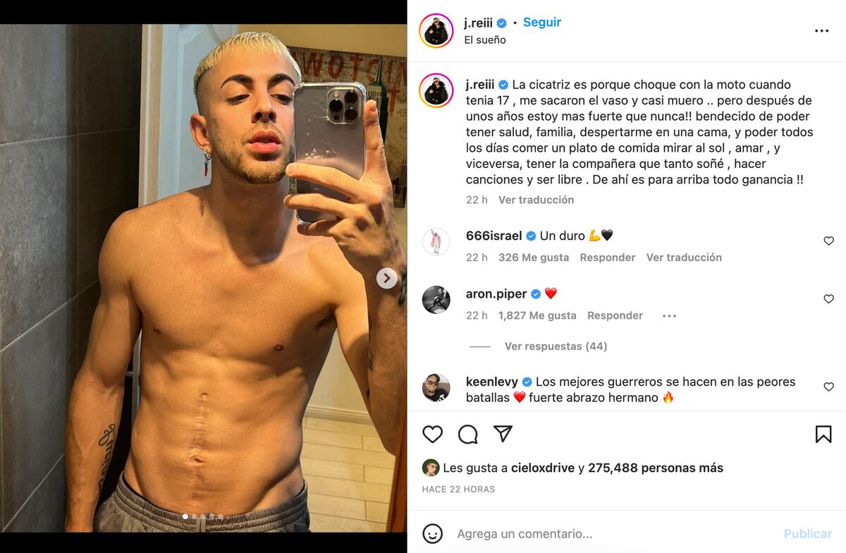 La publicación de J Rei en Instagram sobre su cicatriz.