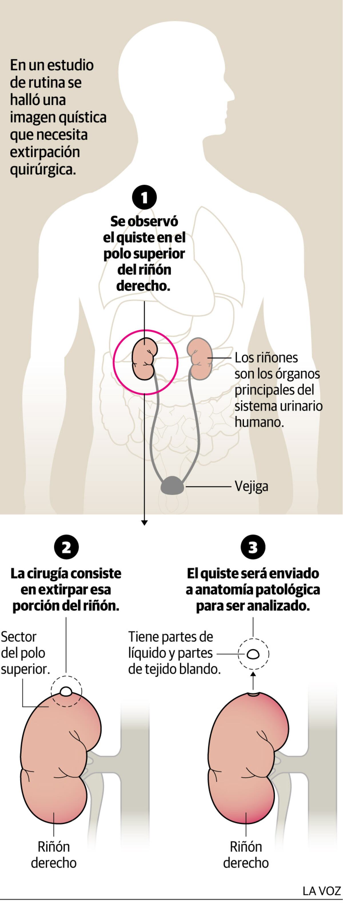 Imagen de la nota