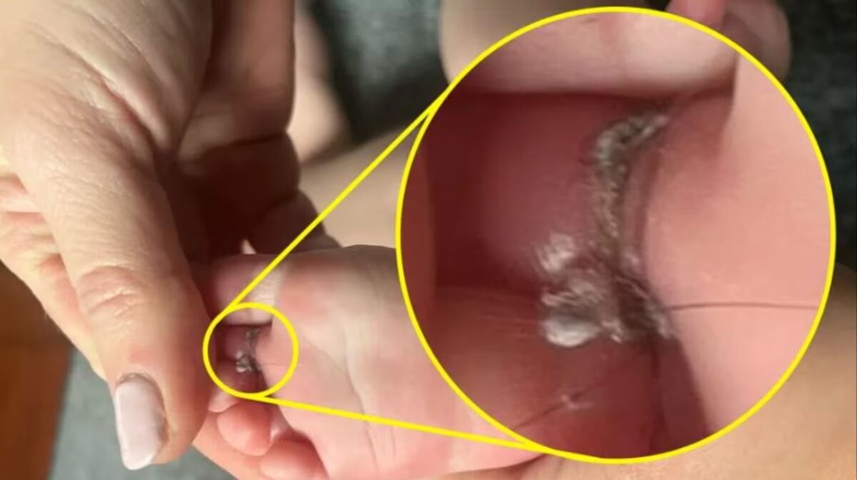 Los pelos se enredador en sus dedos del pie.