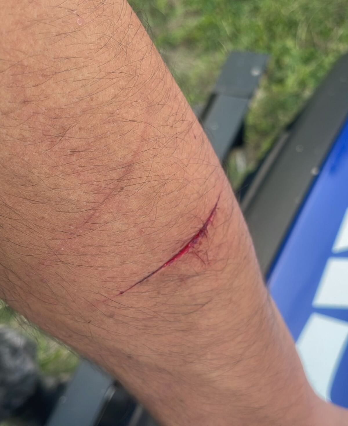 El efectivo resultó herido en su brazo izquierdo. (Policía de Córdoba)