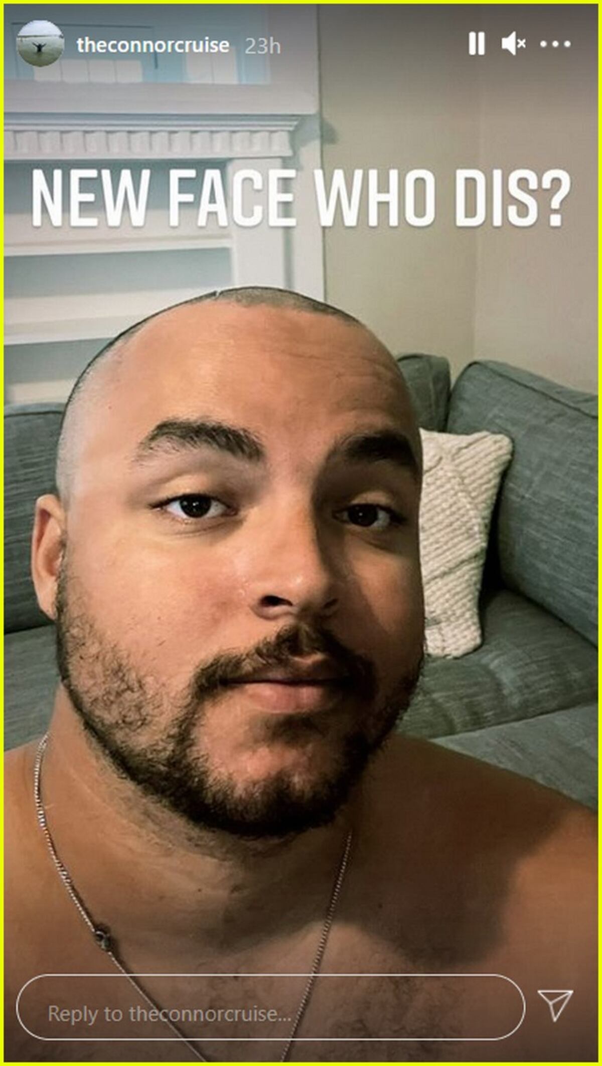 El joven de 26 compartió con sus seguidores su radical cambo de look.