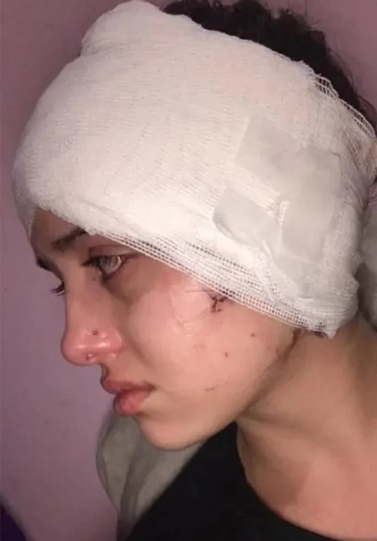 La chica recibió 20 puntos en el rostro. (Facebook)
