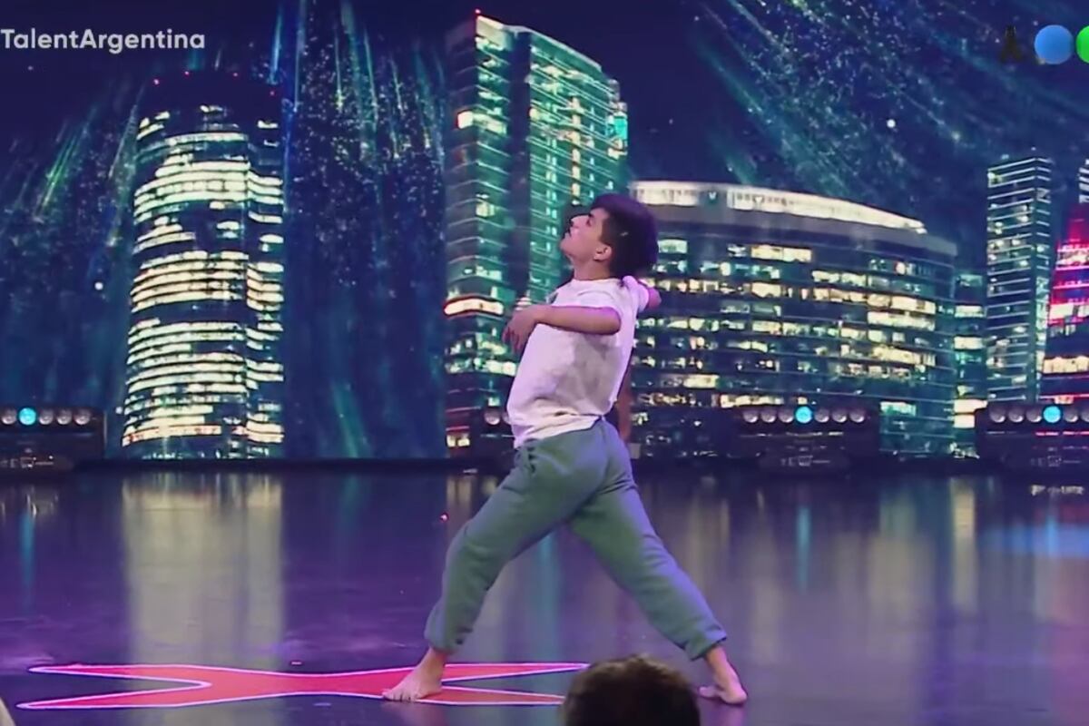 Día Mundial del Moebius: el caso del joven con el síndrome que deslumbró en Got Talent