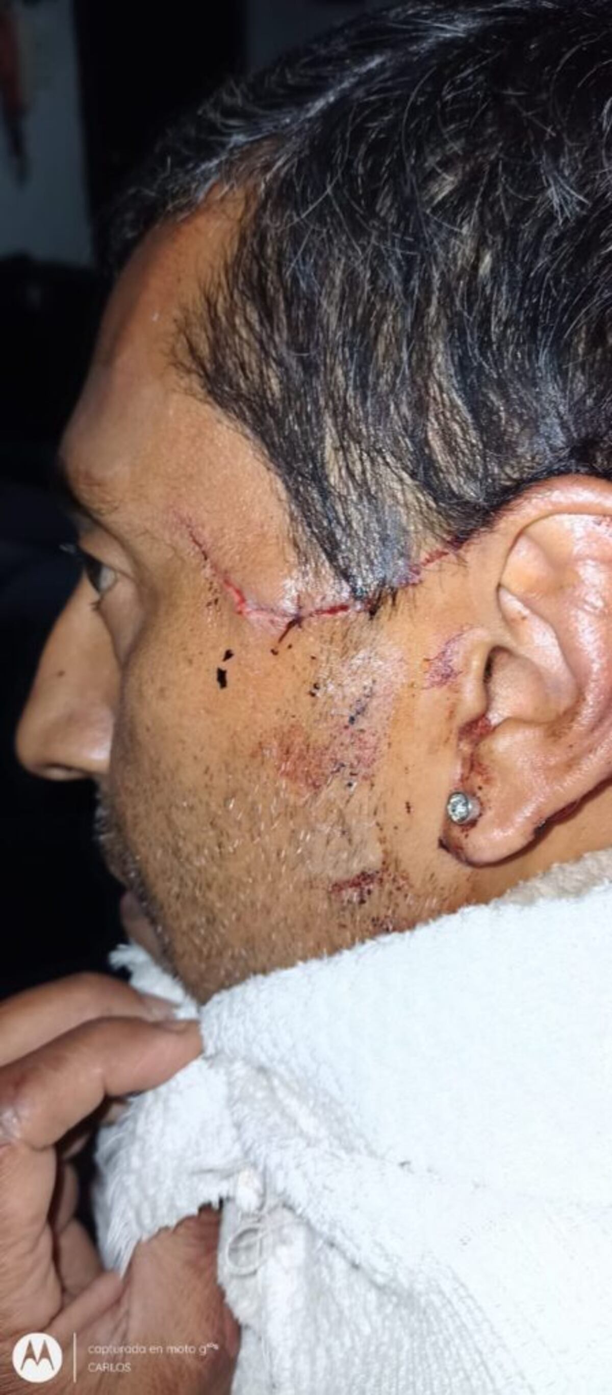 El colectivero que defendió a la quiosquera del robo de la máquina de peluches resultó herido.