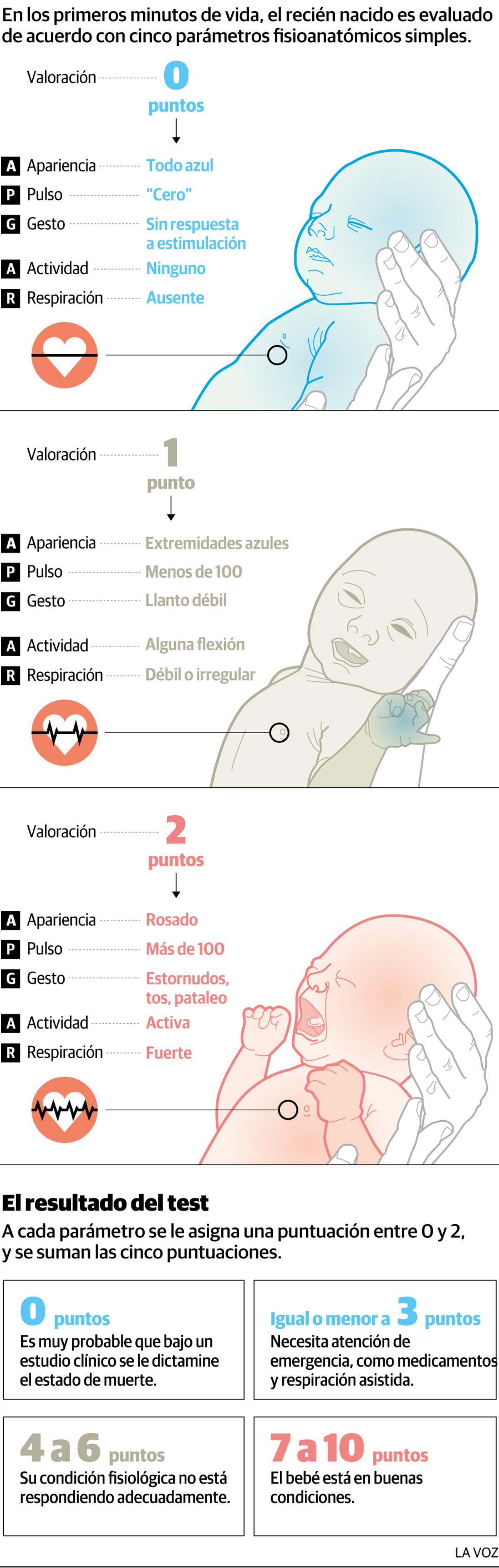 Infografía: Los cinco criterios del test de Apgar