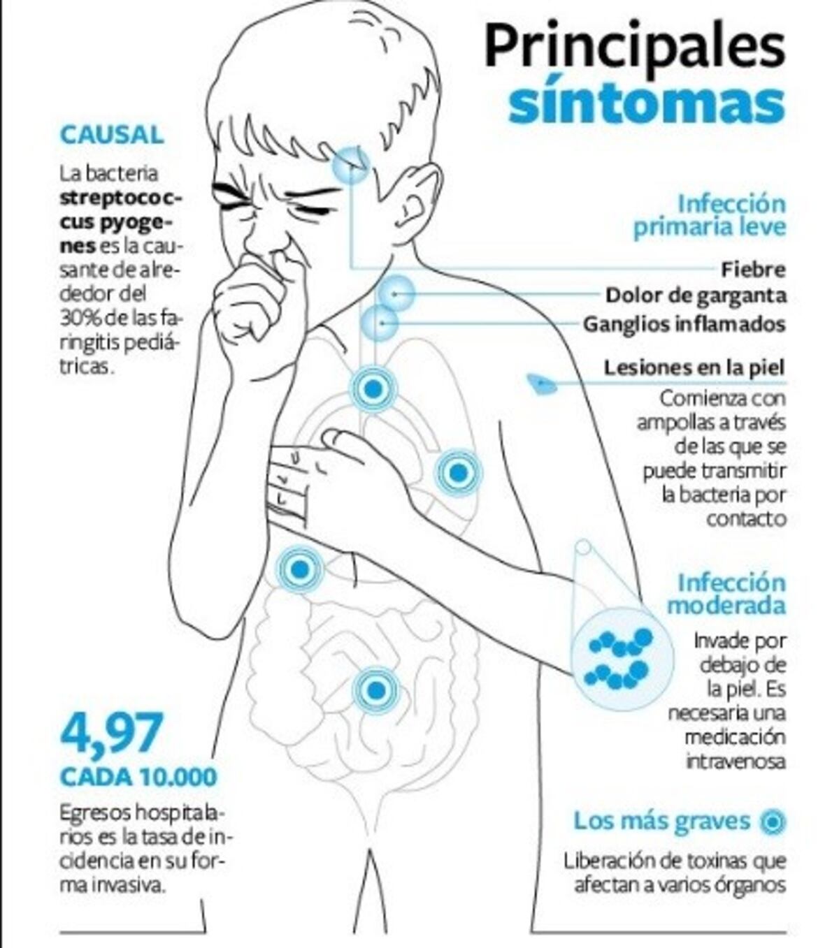 Bacteria streptococcus pyogenes.