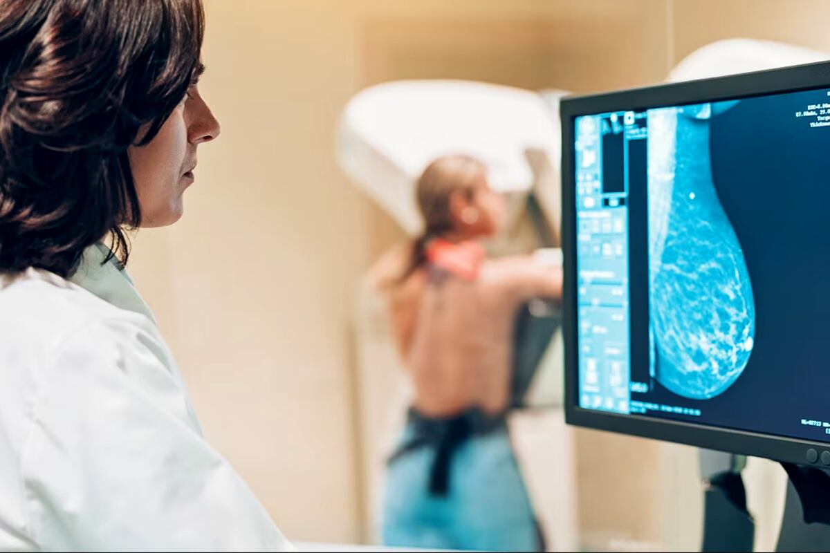 Aumentan los casos de cáncer en menores de 50 años