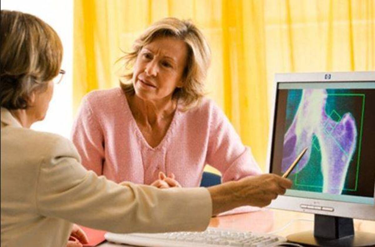 Una de cada cuatro mujeres en menopausia tiene osteoporosis