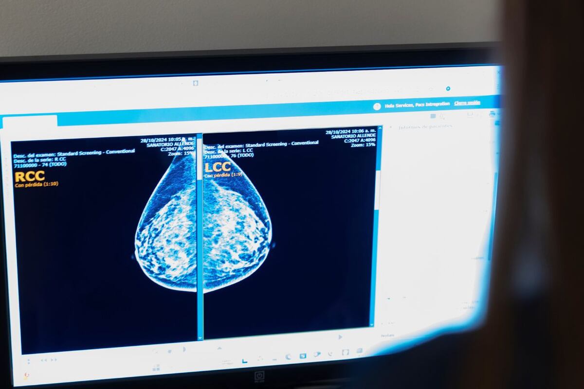 Campaña de Cáncer de Mama 2025: #Mamografiate