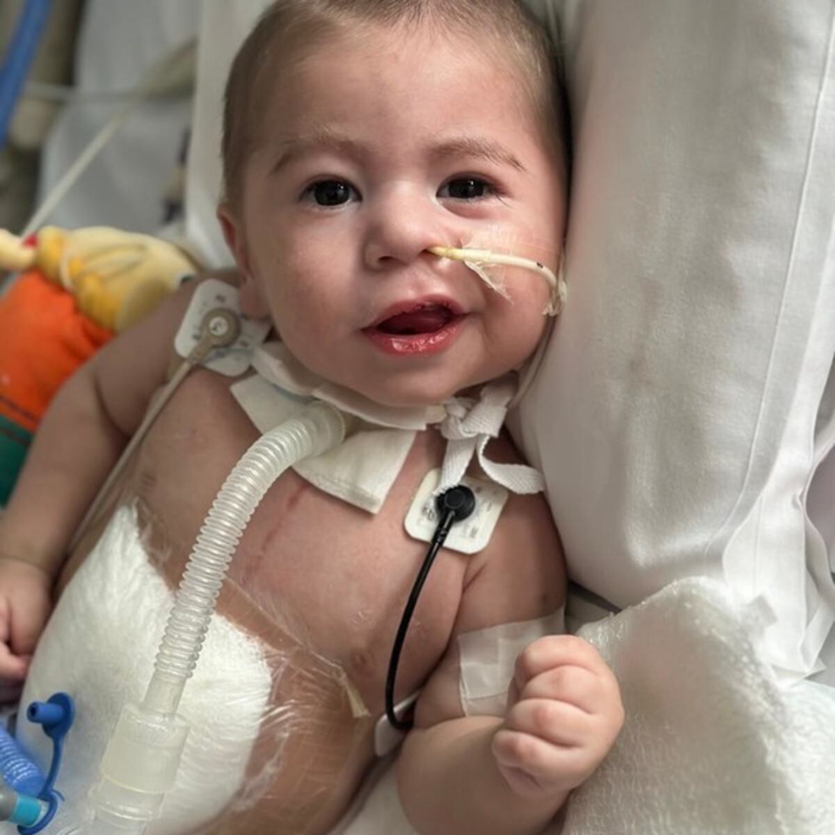 Un corazón que late por dos: la historia del primer trasplante cardíaco pediátrico en asistolia de Argentina. (Gentileza Clarín)