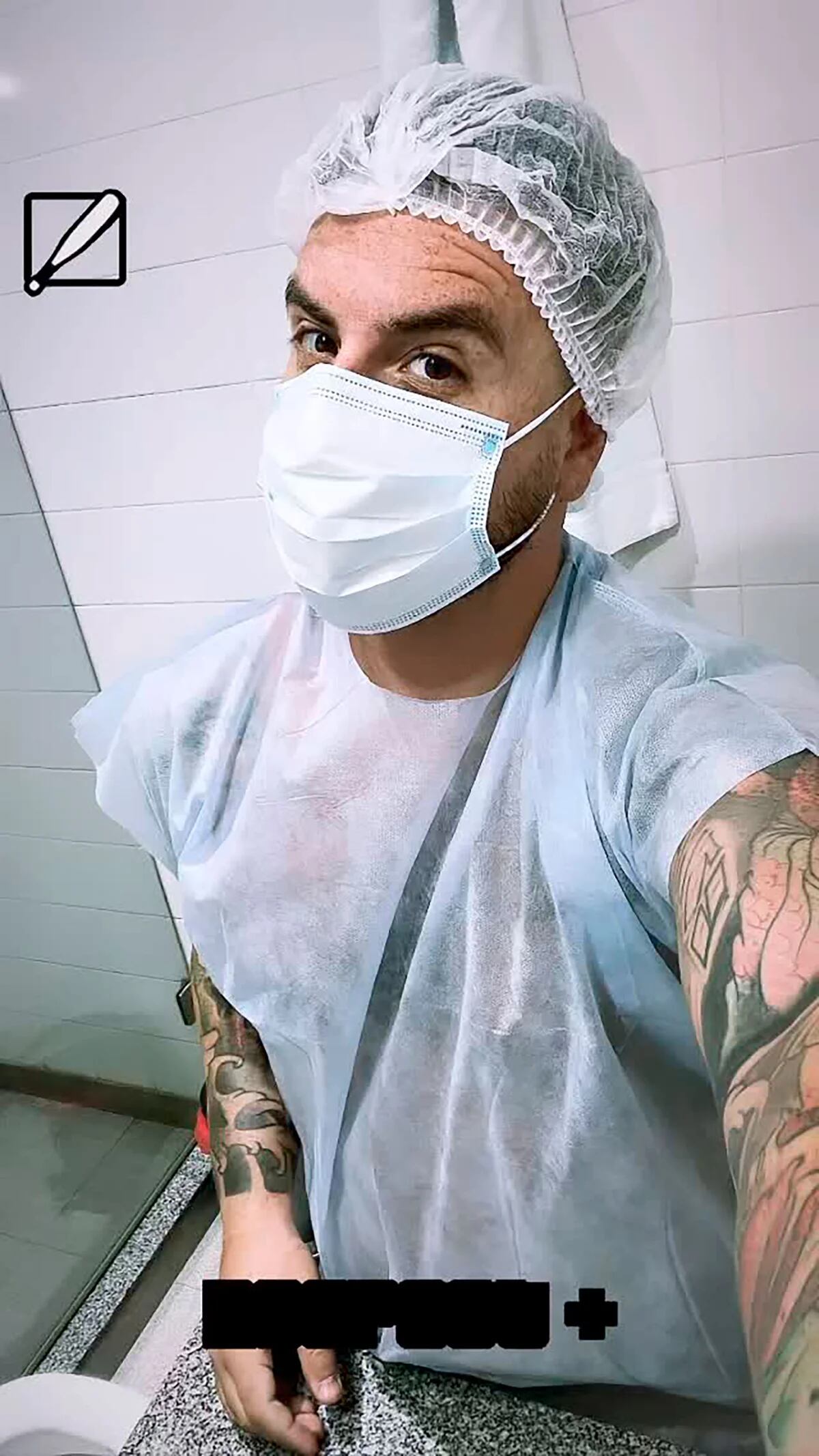 La selfie que subió Fede Bal antes de operarse por 3era vez.