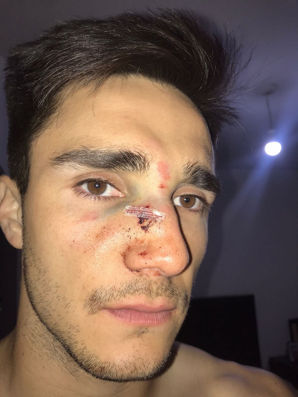 Los incidentes que se dieron en el encuentro entre Lautaro Roncedo y Toro de Moldes el domingo. (Gentileza).