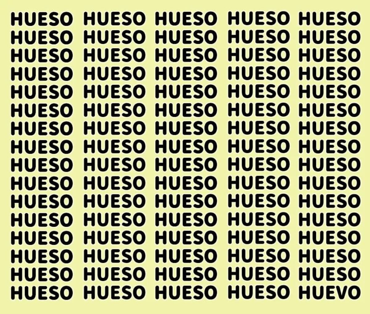 El acertijo visual.