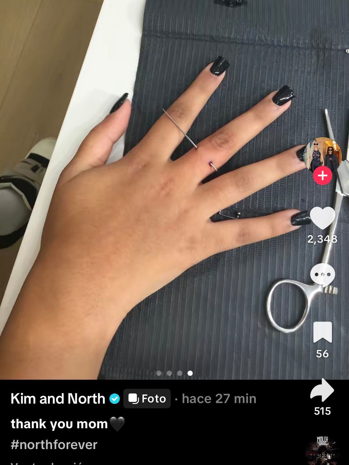 La menor decidió sumarse a la tendencia de los piercings dérmicos en los dedos.