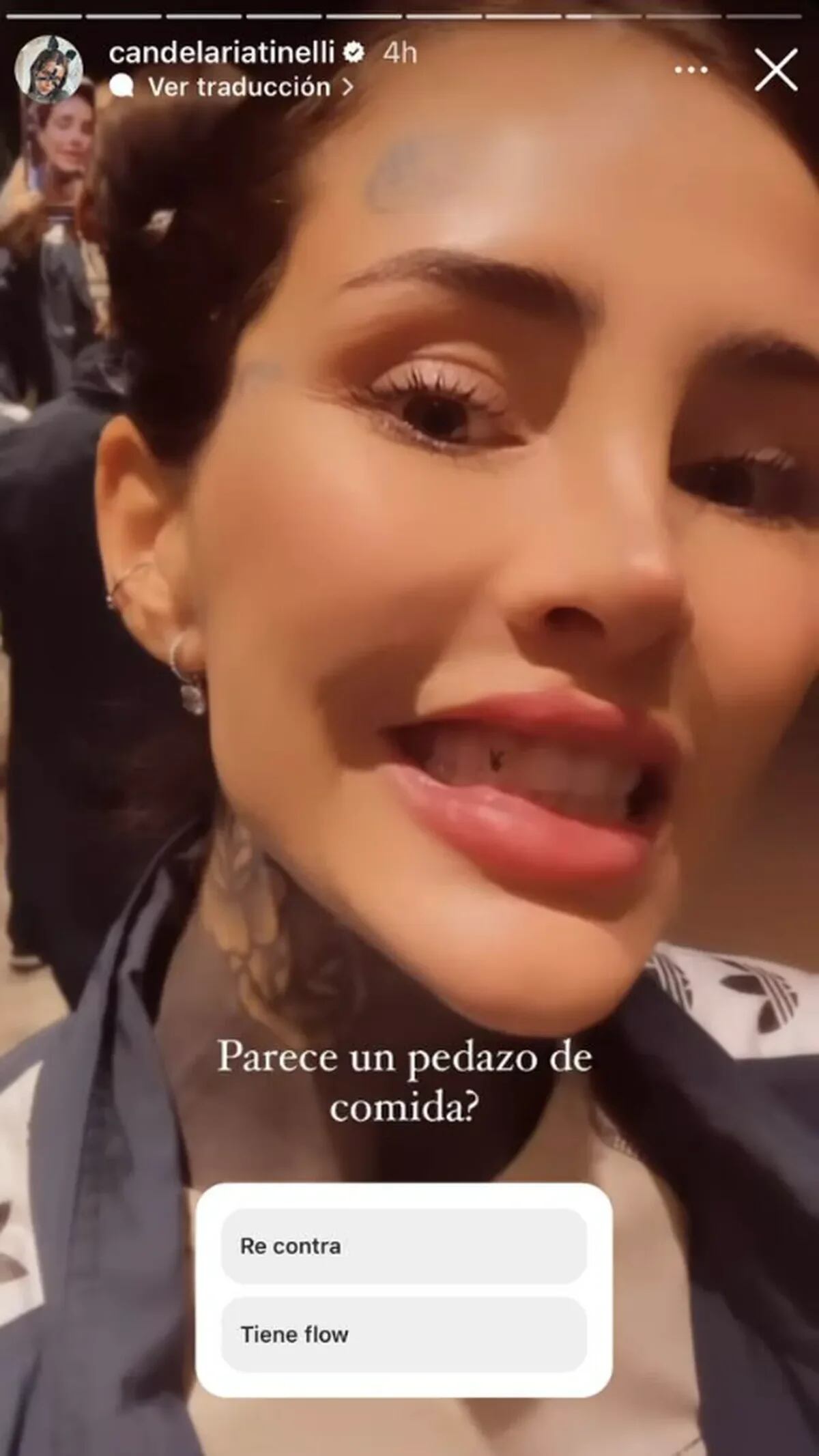 Cande Tinelli mostró el strass dental que se colocó.