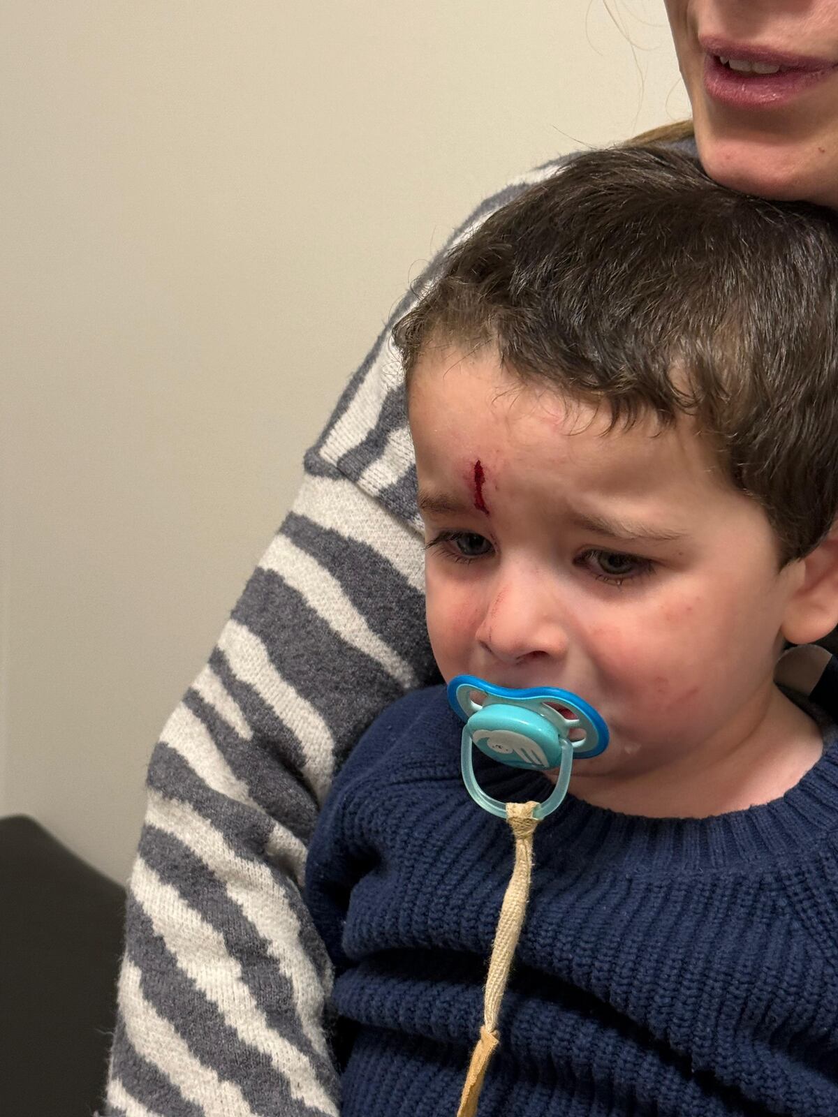 Lolo, el hijo de Camilo Nicolás y Gislena Monteros, terminó en el hospital por un fuerte golpe en la frente (Gentileza Camilo Nicolás)
