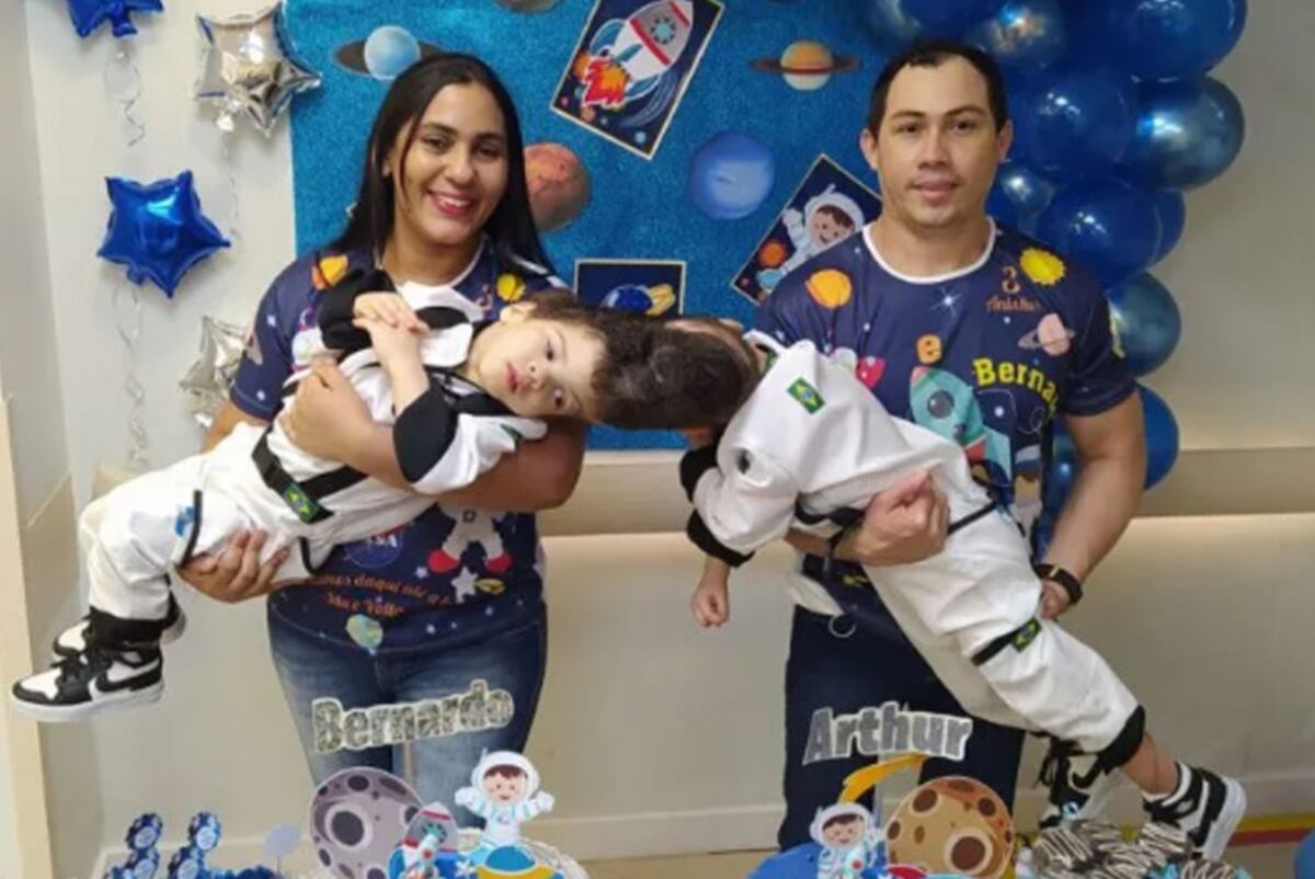 Siameses. Lograron separar a los gemelos Bernardo y Arthur Lima en Brasil. (Foto / PA)