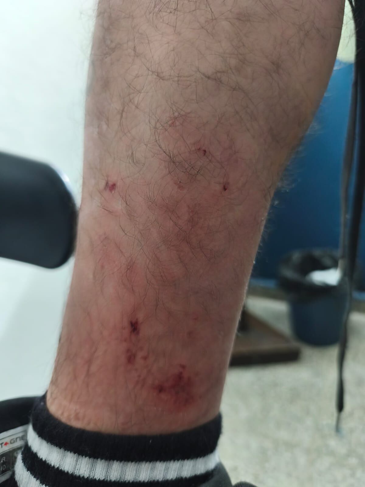 Córdoba. Buscaban un celular robado y una mujer soltó dos pitbulls para atacar a los policías en el operativo.