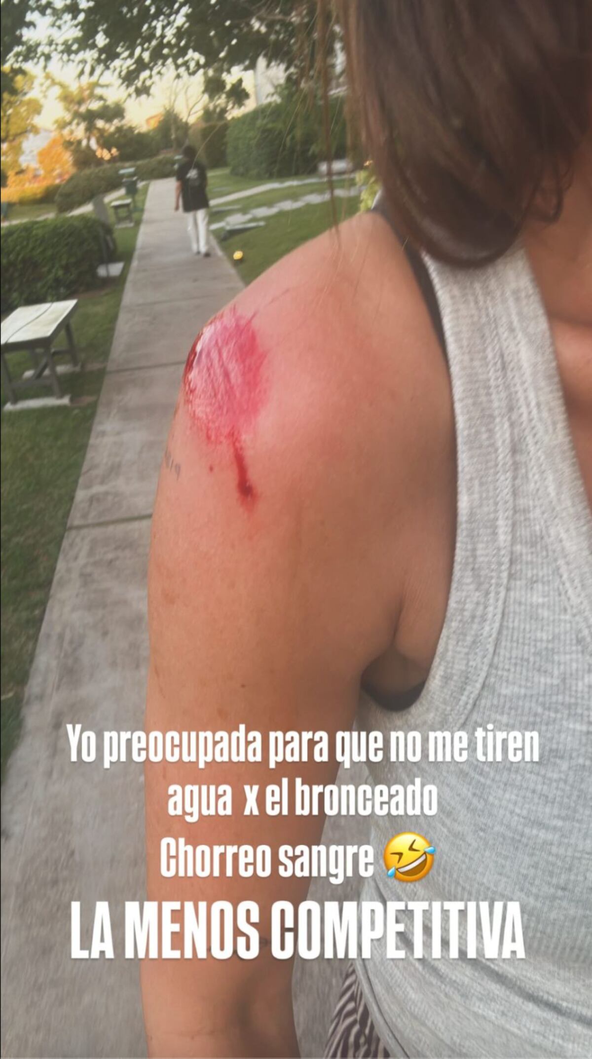 Paula Chaves mostró las lastimaduras que se hizo tras jugar a las escondidas con sus hijos. (Fotos: Instagram)