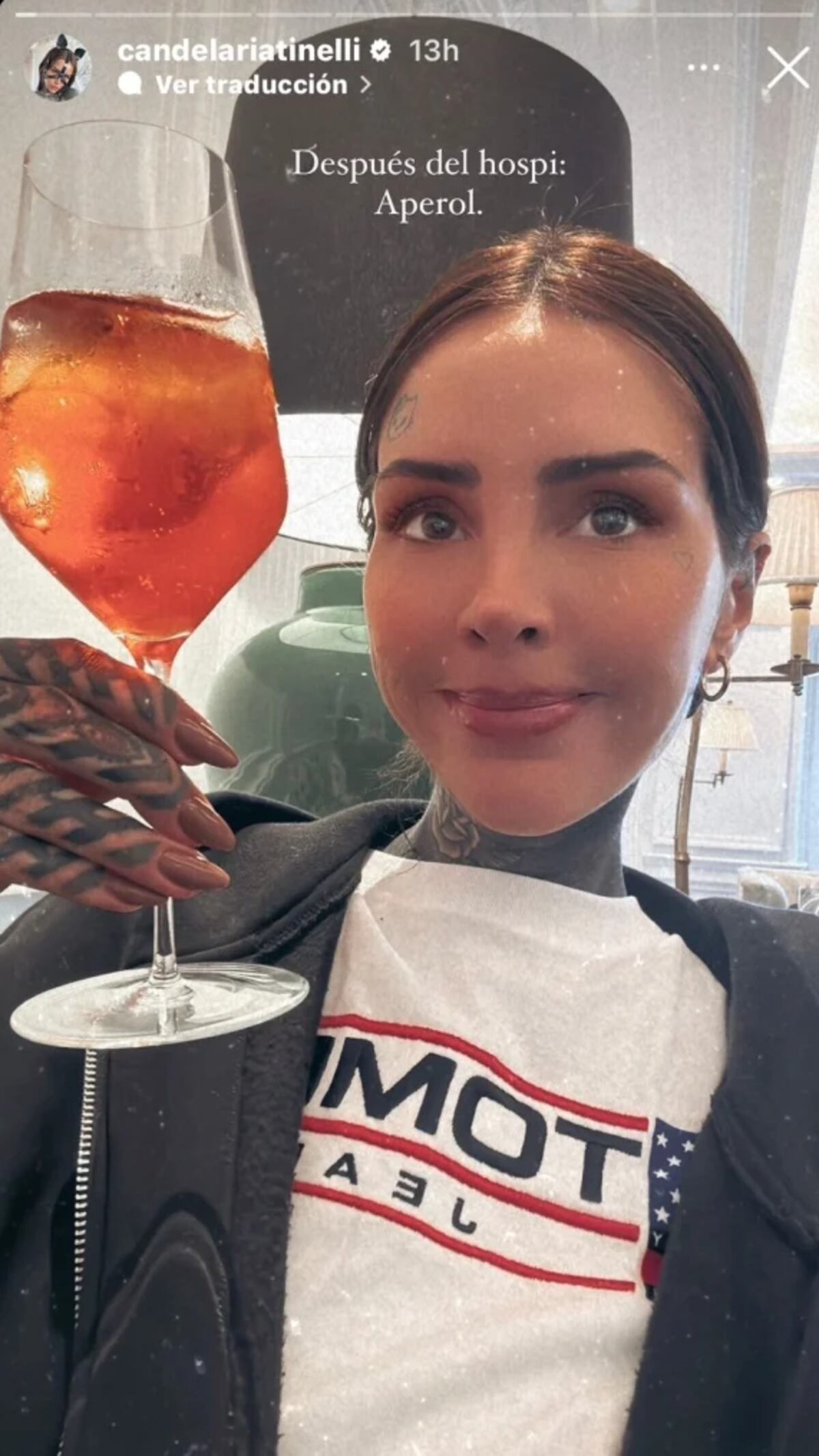 Cande Tinelli tuvo una reacción alérgica y tuvo que ser internada en España. (Captura Instagram Cande Tinelli)