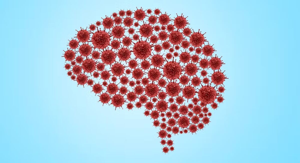 Niebla mental. (DOERS / Shutterstock)