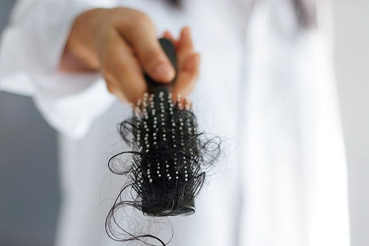 La caída del cabello es un problema que aqueja tanto a hombres como mujeres. / Hair Recovery