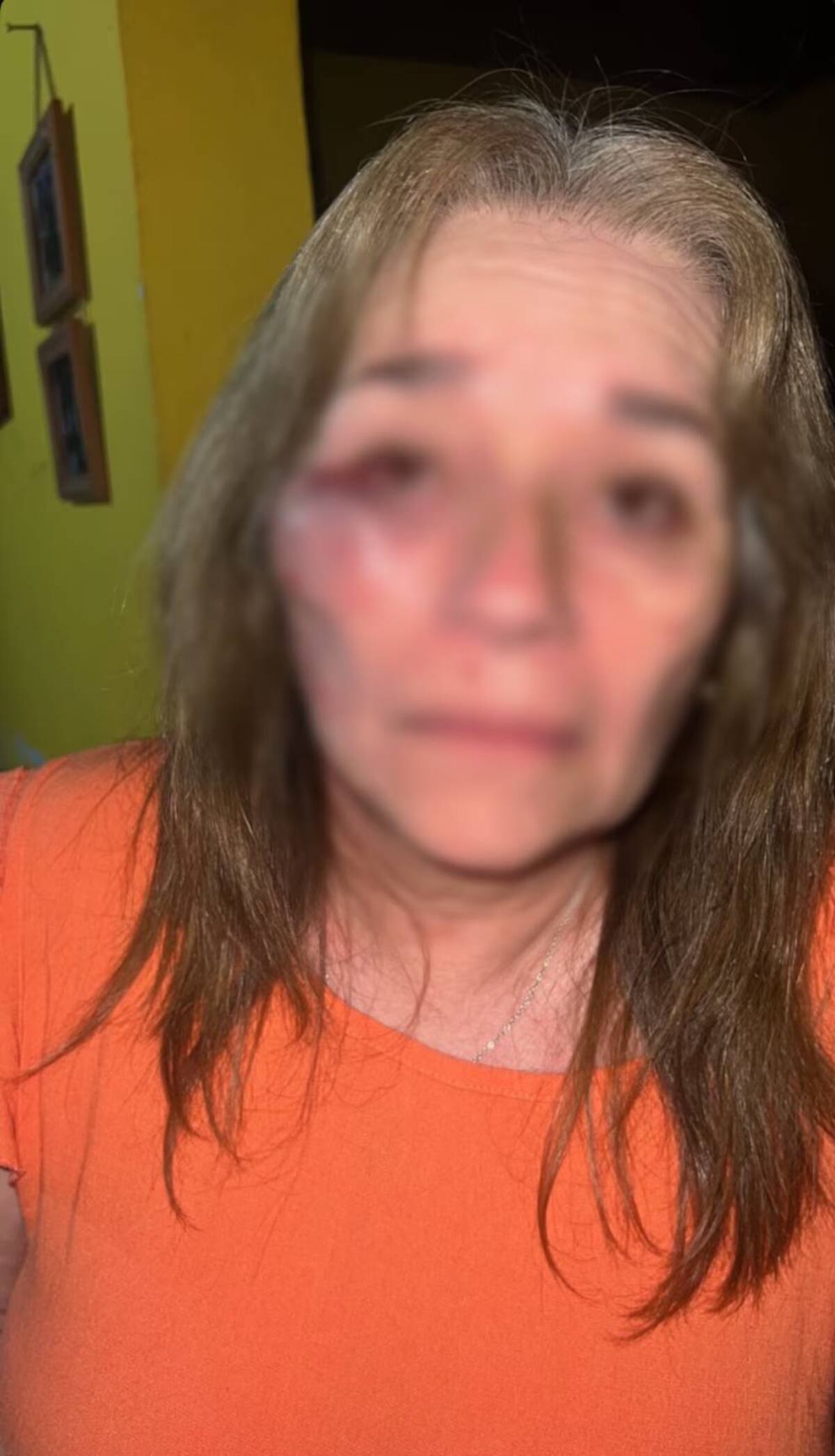 Las lesiones de la suegra del presunto agresor. (Foto: Gentileza)