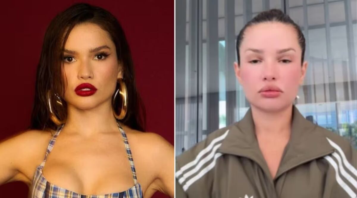 Juliette, la cantante brasileña que sufrió una reacción alérgica tras aplicarse semen de salmón en su cara.