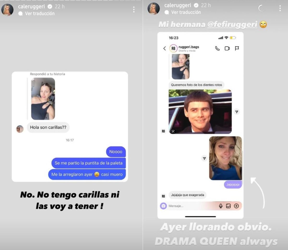 Cande Ruggeri mostró el percance que tuvo con uno de sus dientes (Captura de pantalla)