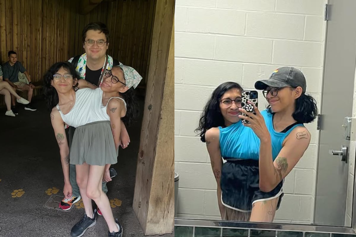 Las gemelas siamesas y el novio de una de ellas.