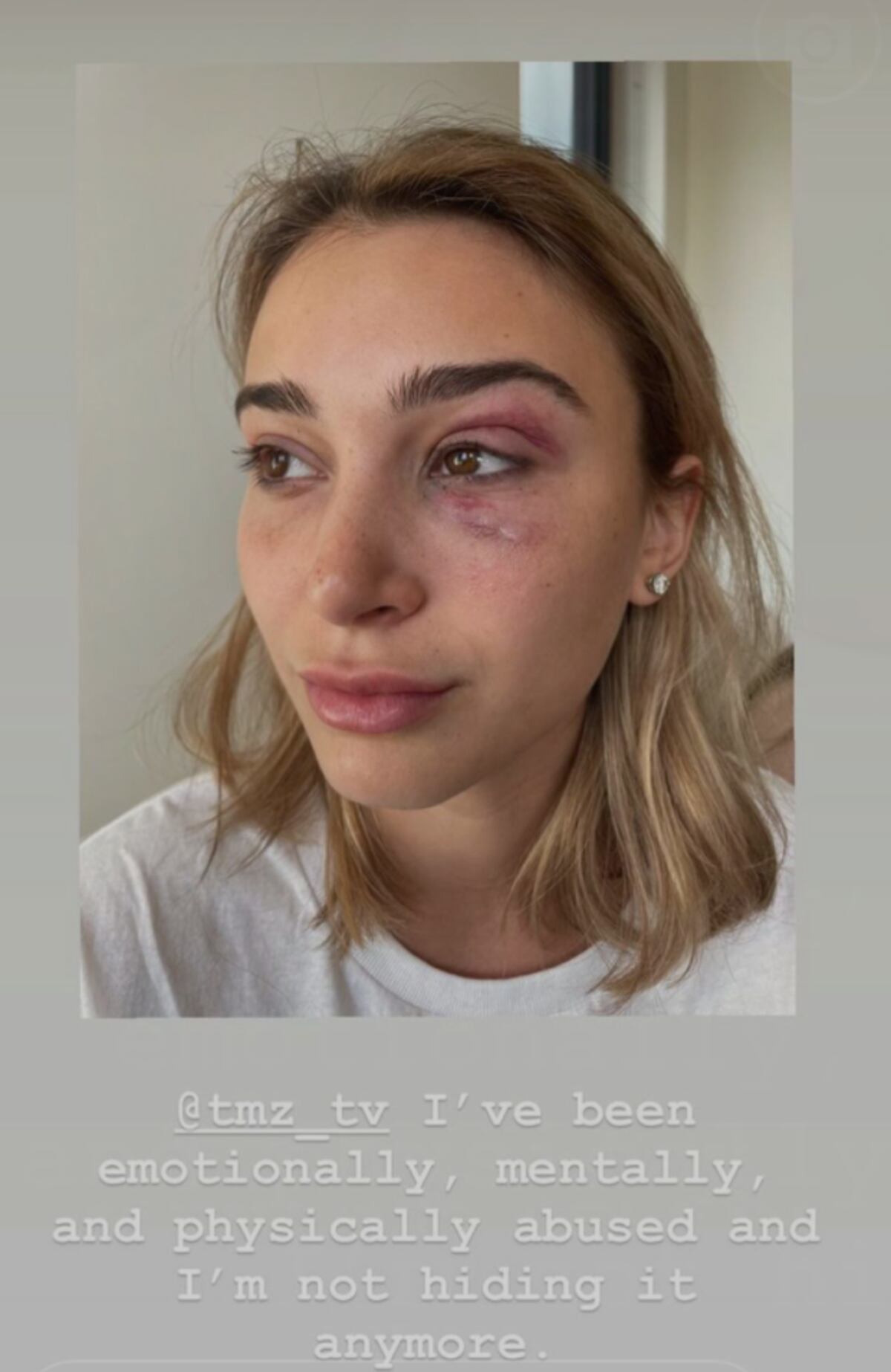 Camaryn Swanson, la novia de Tyga, lo denunció por violencia de género