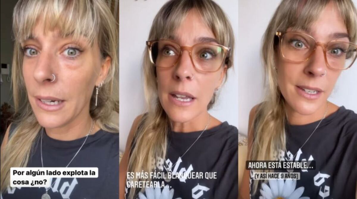 Dani La Chepi mostrando en sus historias cómo se le hinchó un ojo por la angustia que está viviendo.