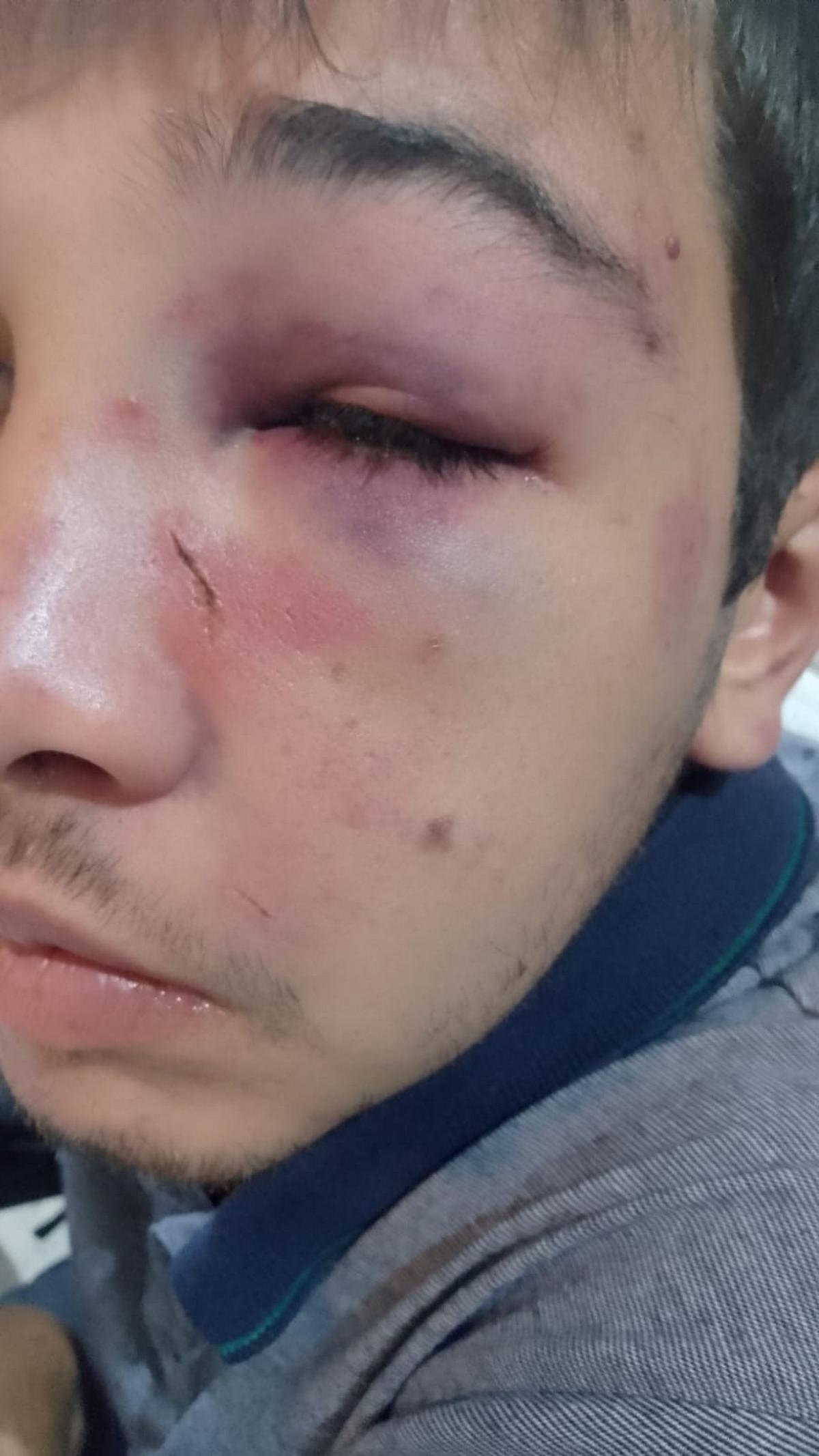 Tomás Bravo, de 22 años, fue gravemente atacado por una patota cuando salió a bailar con su novia. (Gentileza: Cadena 3).