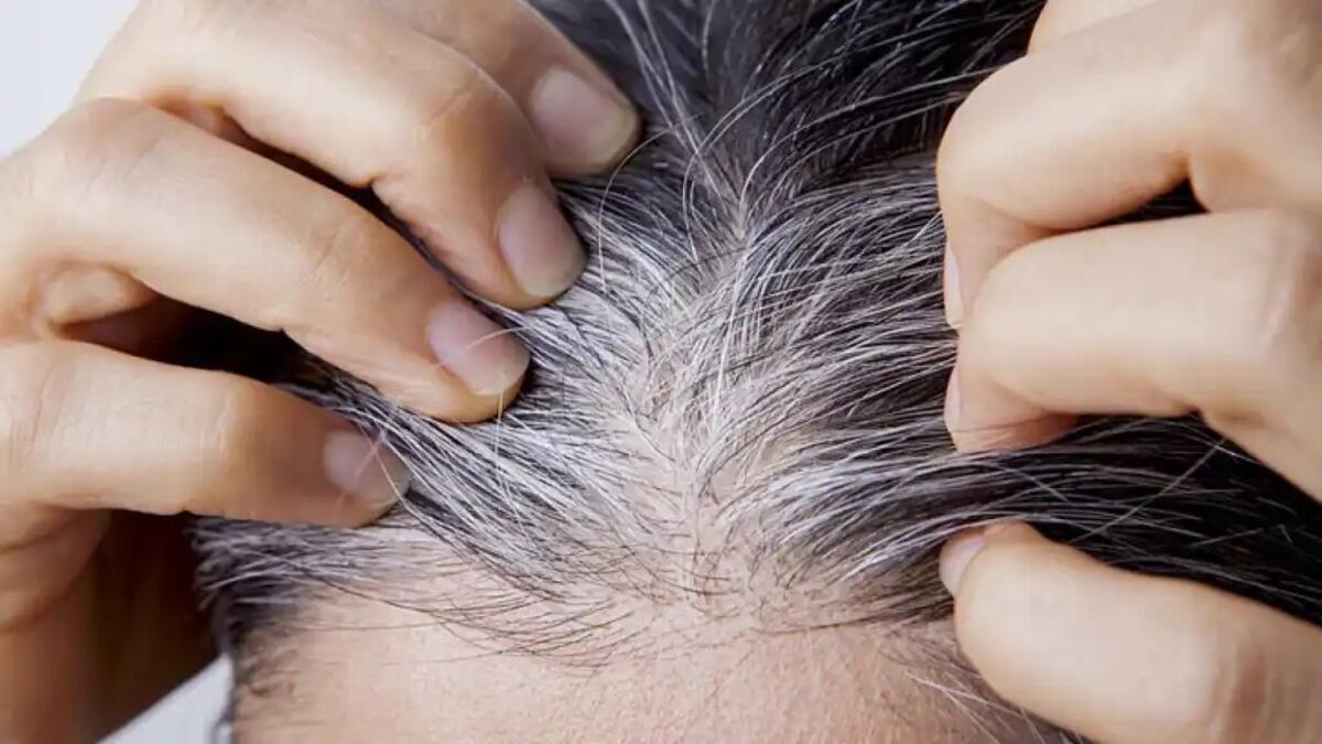 Los 3 nutrientes esenciales para retrasar la aparición de canas, según la ciencia