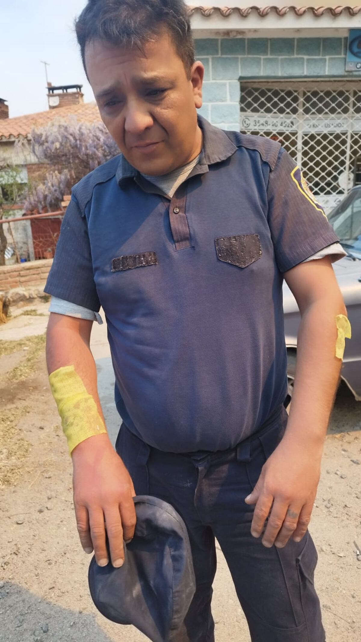 Dramático rescate en San Esteban: un policía con quemaduras y un patrullero consumido por el fuego (Policía).
