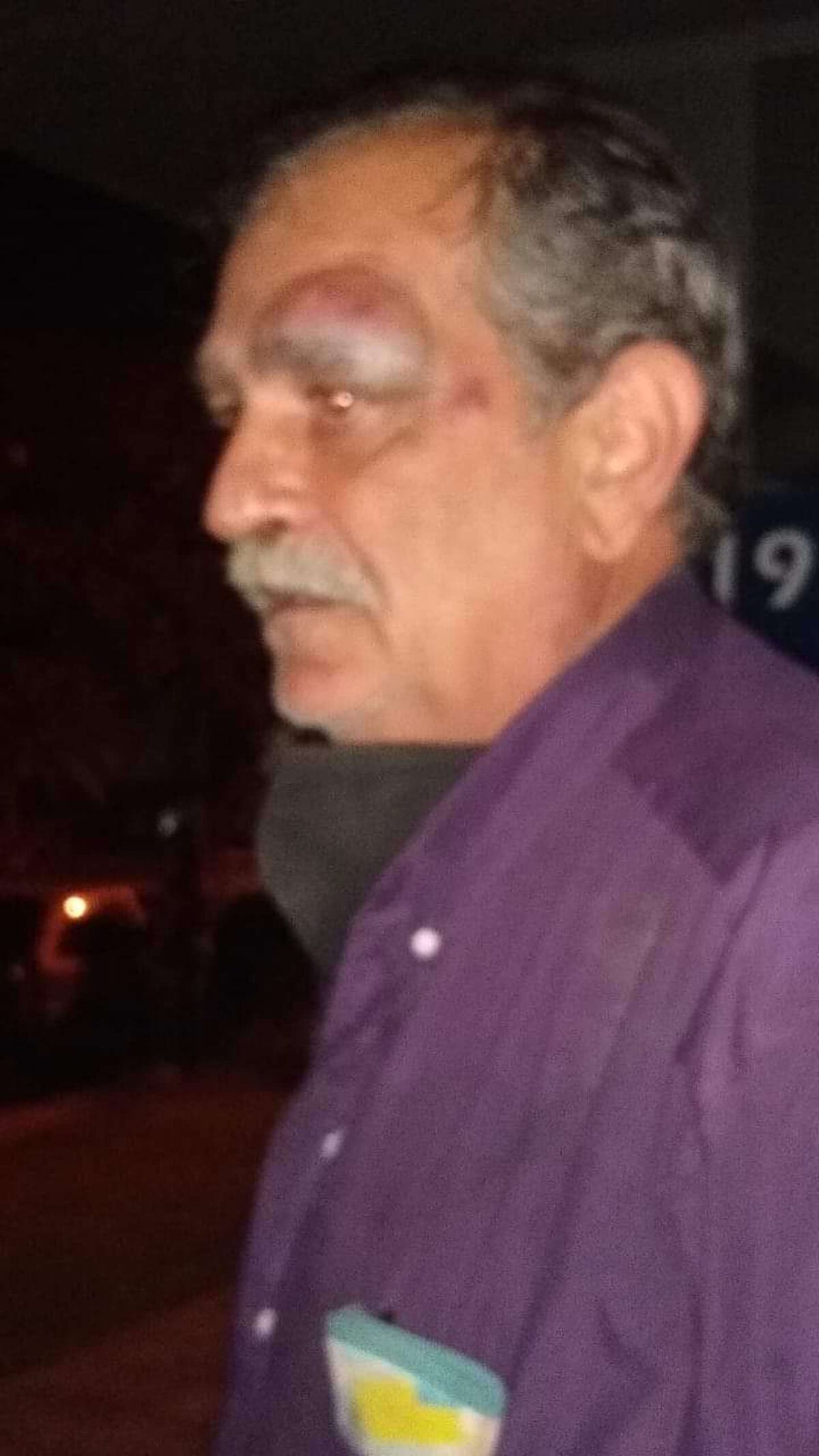 Gustavo Senn denunció que estando detenido en una comisaría de Formosa, uno de los policías le pegó una patada y casi le saca un ojo. (TN)