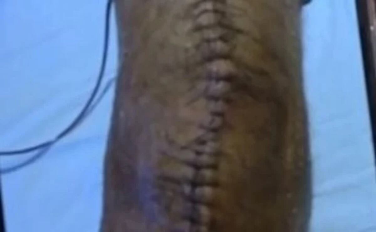 Impactante. Así luce la rodilla de Miguel del Sel.