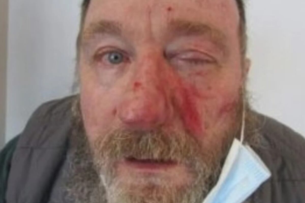 Mark Dinning (60). El hombre golpeado. (Policía de Iowa)